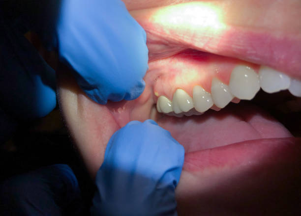 Best Emergency Dental Surgery in Coyne Center, IL